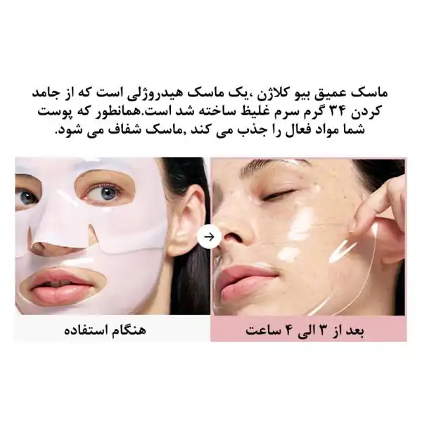 پک 4 عددی ماسک آبرسان و تقویت کننده هیالورونیک بایودنس  ساخت کره جنوبی اصلی